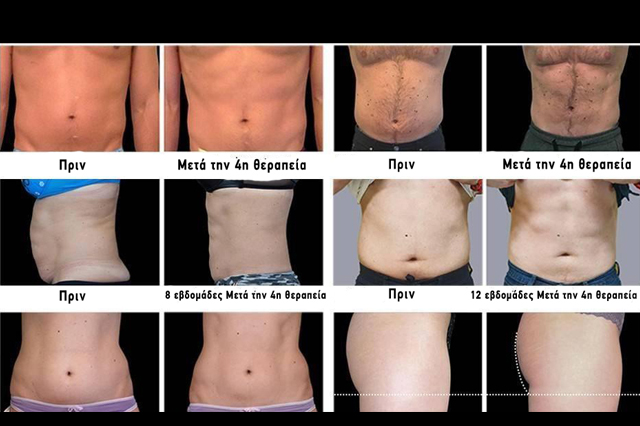 before-after before-after